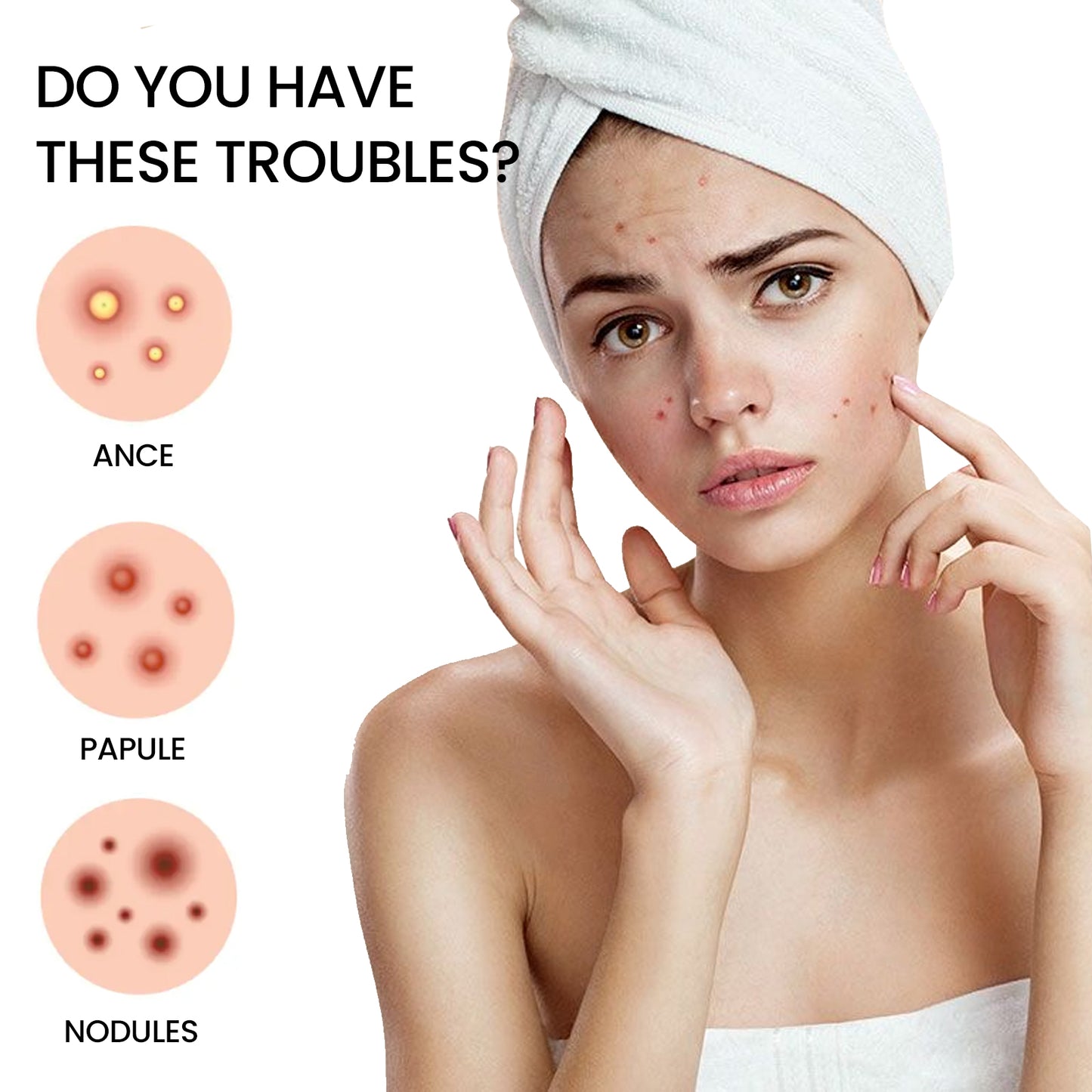 GDBadais Pimples Patch, Repair Pockmarks Lighten Pimples Blemishes Cover Pimples