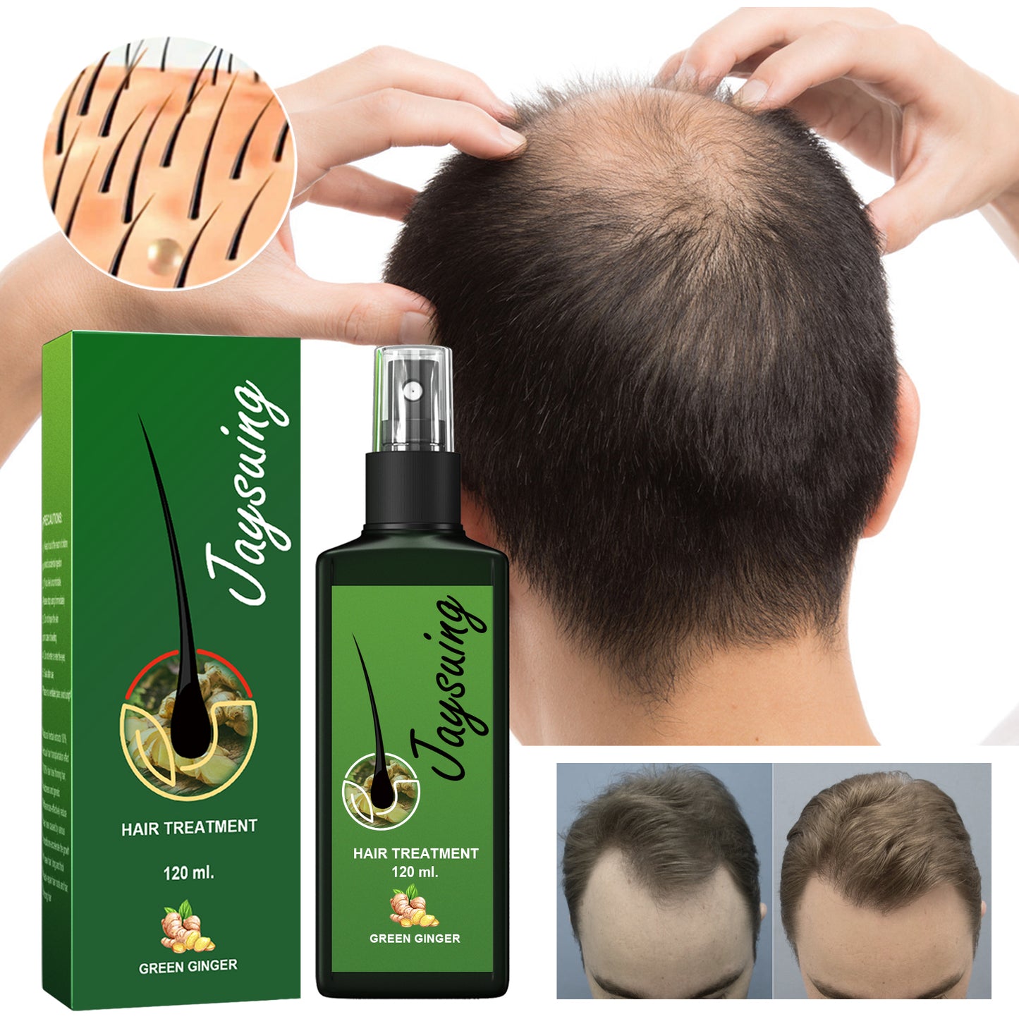 GDBadais Hair Care Solution Gently Nourishes And Massages Scalp, Moisturizes And Softens Hair Care Spray