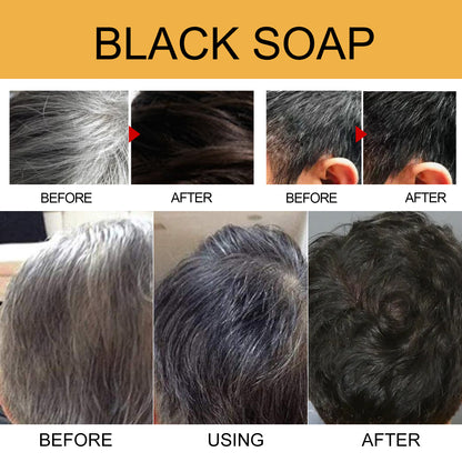 GDBadais Black Soap, Black Dense Hair Care Clean Scalp Supple And Strong Shampoo Soap