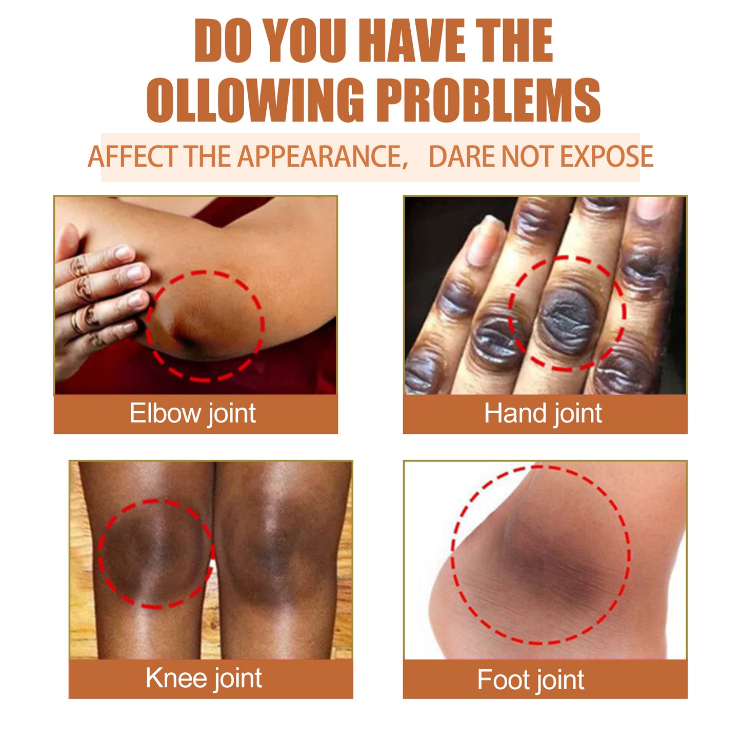 GDBadais Papaya Seed Skin Care Oil Lightening Dark Spots, Bending Joints, Elbows, Brightening Skin And Moisturizing Oil