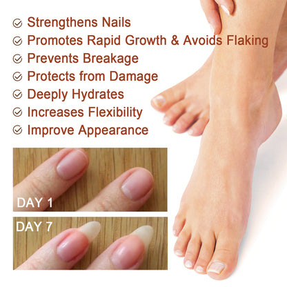 GDBadais 7 Day Nail Care Essence Grey Nail, Hand, Foot And Nail Nourishing Cleansing Essence