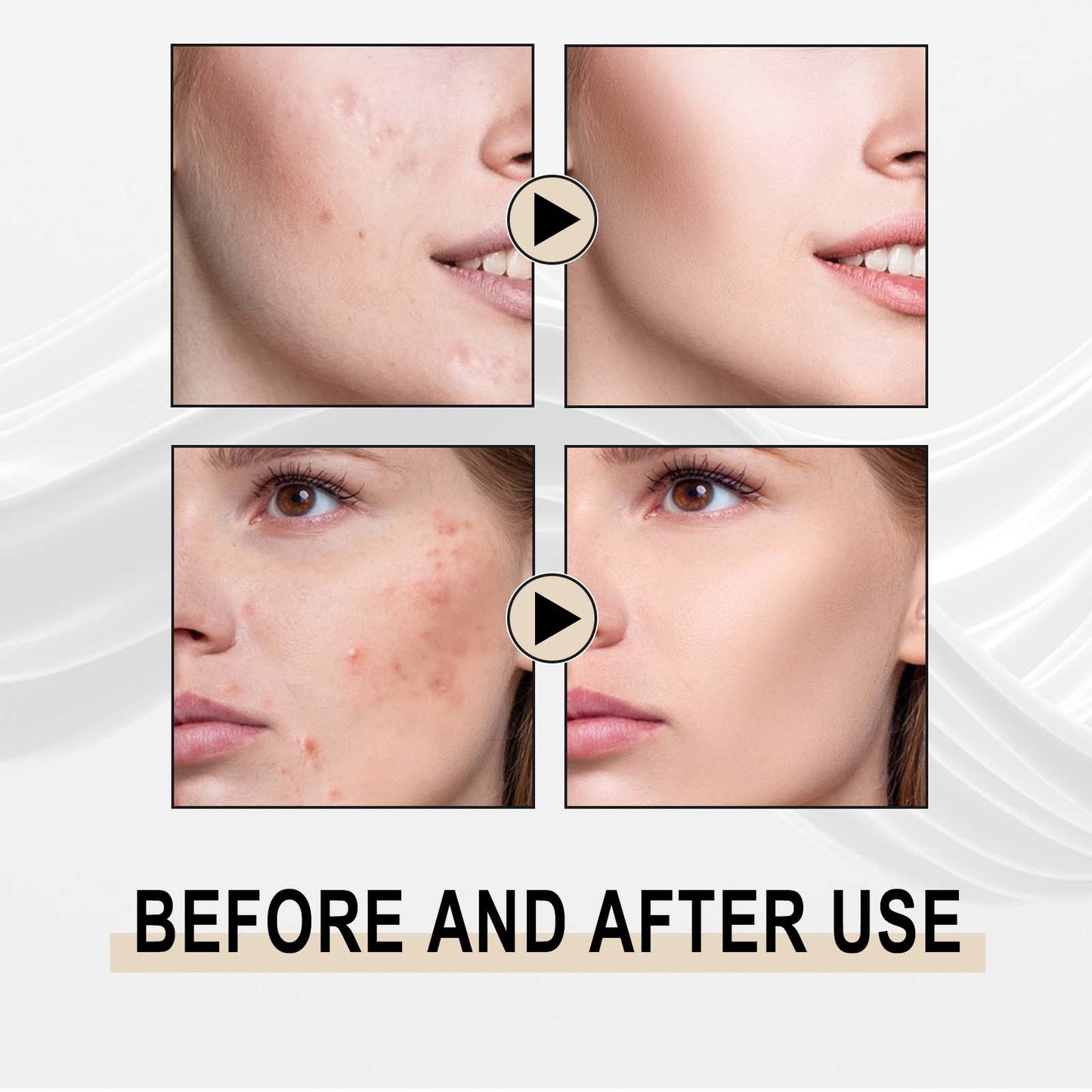 GDBadais Lactose Solution, Exfoliate Remove Blackheads Shrink Pores Clean And Moisturize SkinEssence