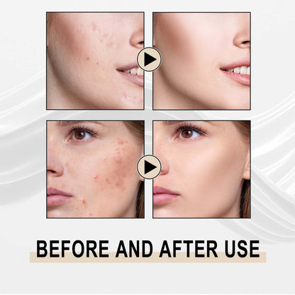 GDBadais Lactose Solution, Exfoliate Remove Blackheads Shrink Pores Clean And Moisturize SkinEssence