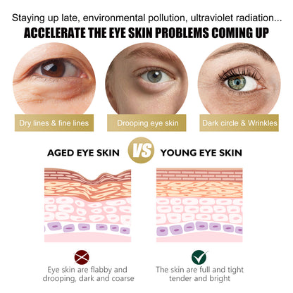 GDBadais Retinol Eye Cream Stick Reduces Eye Bags, Dark Circles And Wrinkles, Moisturizes And Tightenes The Skin Around The Eyes