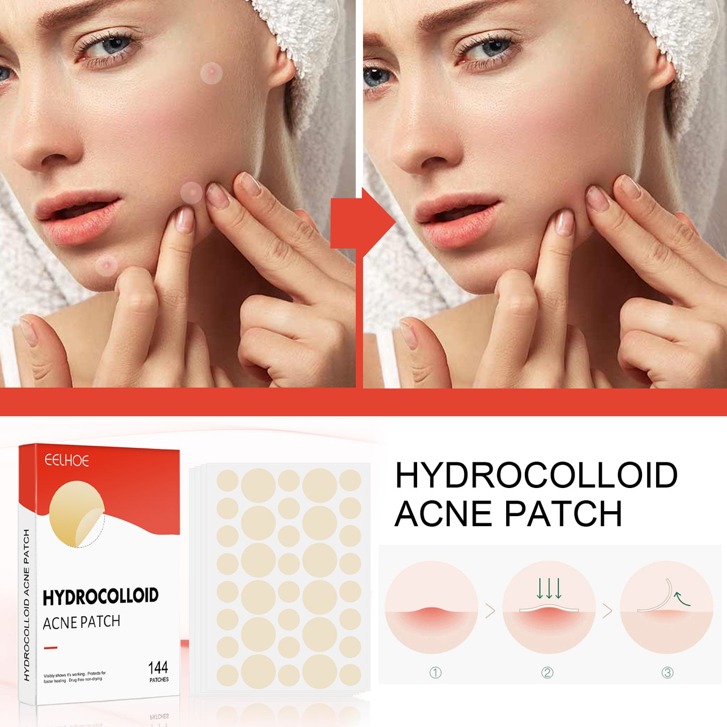 GDBadais Hydrocolloid Acne Patch Face Invisible Makeup Closed Mouth Acne Clear Acne Waterproof Breathable Facial Treatment