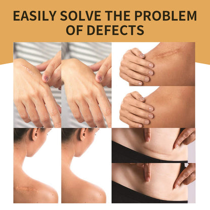 GDBadais Invisible Concealer, Skin Concealer Tattoo Scar Cover Invisible Waterproof Skin Tone Cover