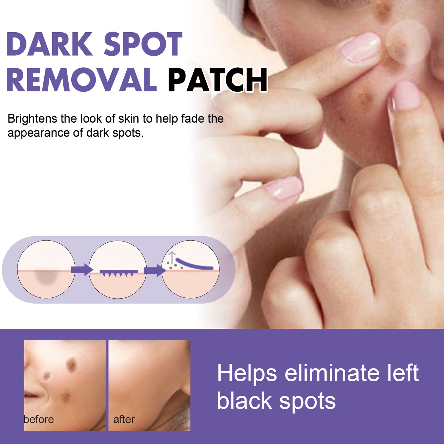 GDBadais Dark Spot Removal Patch, Lightening Face Dark Spots Melasma Spots Melanin Moisturizing Whitening Skin Spot Patch