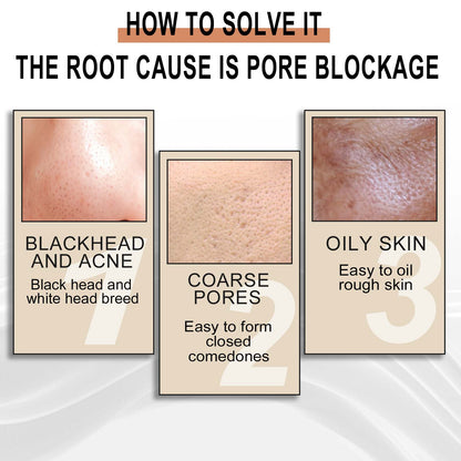 GDBadais Lactose Solution, Exfoliate Remove Blackheads Shrink Pores Clean And Moisturize SkinEssence