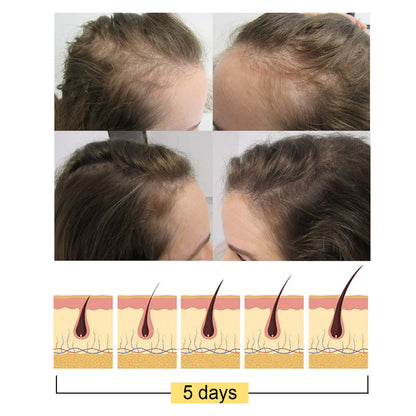 GDBadais Ginger Dense Hair Soap, Moisturizes Hair Ends And Roots Cleansing Scalp Hair Care Shampoo Soap