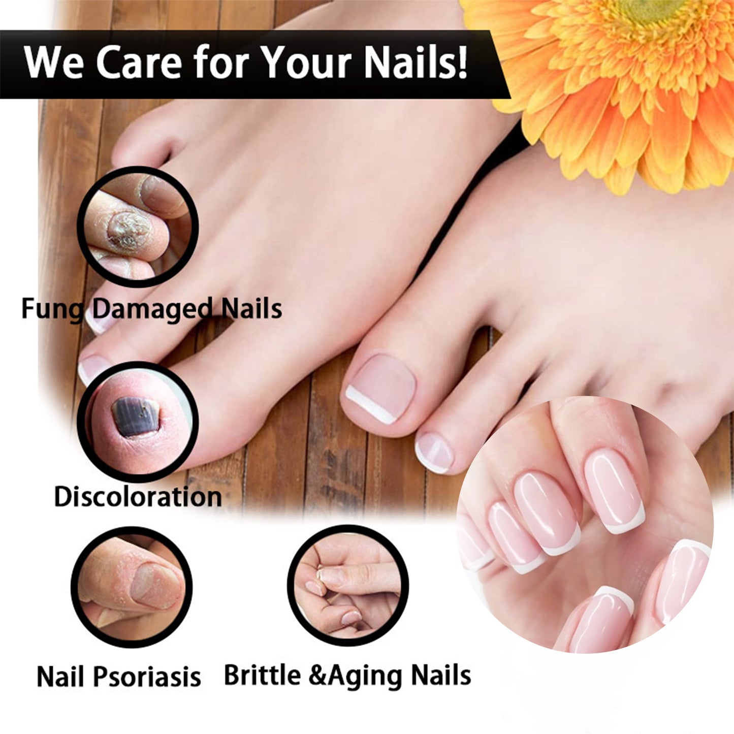 GDBadais Nail Repair Solution Thickening Brightening Nails Removing Gray Nails Dead Skin Repair Nourishing Nail Care Solution