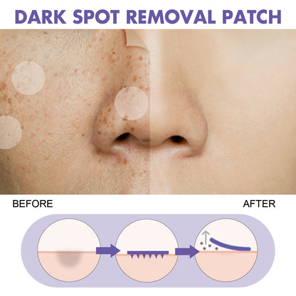 GDBadais Dark Spot Removal Patch, Lightening Face Dark Spots Melasma Spots Melanin Moisturizing Whitening Skin Spot Patch