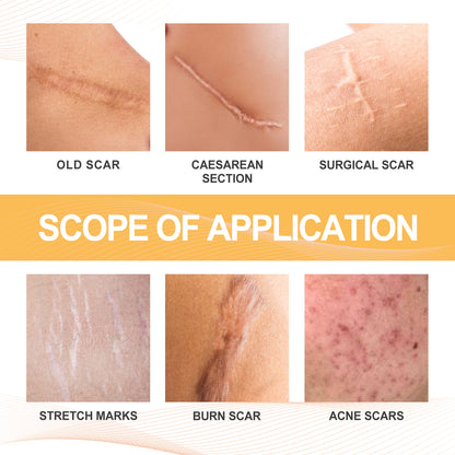 GDBadais Melittin Spray For Reducing Postpartum Pregnancy Scars Smoothing Skin Body Care Spray