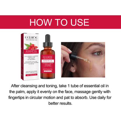 GDBadais Rose Hip Facial Essential Oil Facial Body Moisturizing Skin care Supple Hair Care Massage Essential Oil