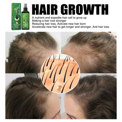 GDBadais Hair Care Spray Nourishing And Nourishing Hair Massage Repair Hair And Scalp Care Solution