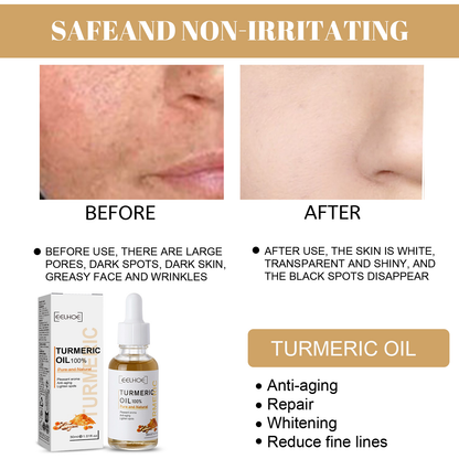 GDBadais Turmeric Correction Essence Facial Care Hydrating Moisturizing Gentle Moisturizing Skin Care Essence