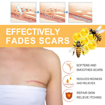 GDBadais Melittin Spray For Reducing Postpartum Pregnancy Scars Smoothing Skin Body Care Spray
