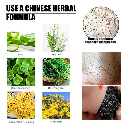 GDBadais Blackhead Removal Mask, Peel Off Remove Blackhead Activated Carbon Cleansing Face Mask