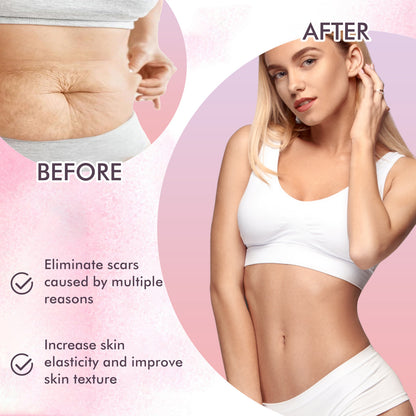 GDBadais Skincare Body Oil, Fade Scars And Fine Lines Of Pregnancy Moisturize And Repair Delicate And Smooth Body Skin