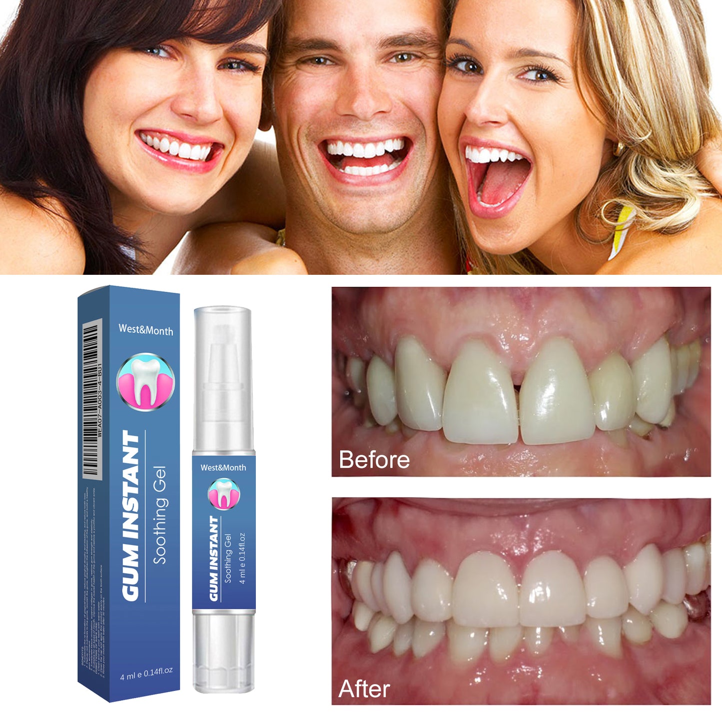 GDBadais Gum Instant Soothing Gel, Relieve Gums Swelling And Pain Clean Teeth Plaque Stains And Whiten Teeth Gel