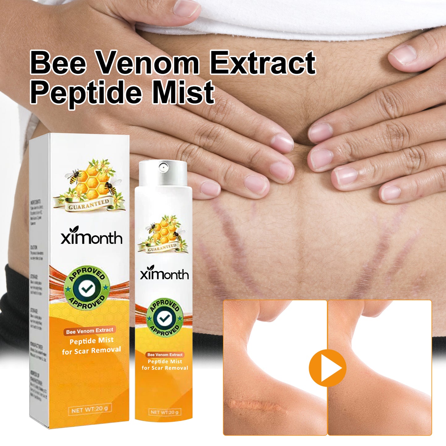 GDBadais Melittin Spray For Reducing Postpartum Pregnancy Scars Smoothing Skin Body Care Spray