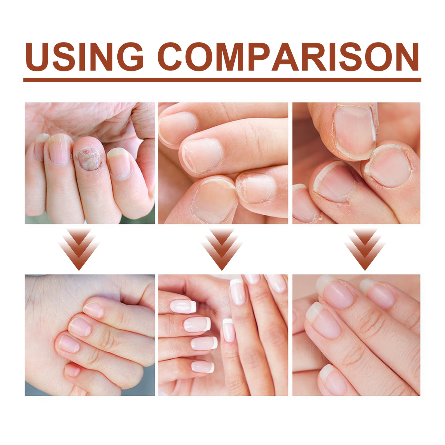 GDBadais 7 Day Nail Care Essence Grey Nail, Hand, Foot And Nail Nourishing Cleansing Essence