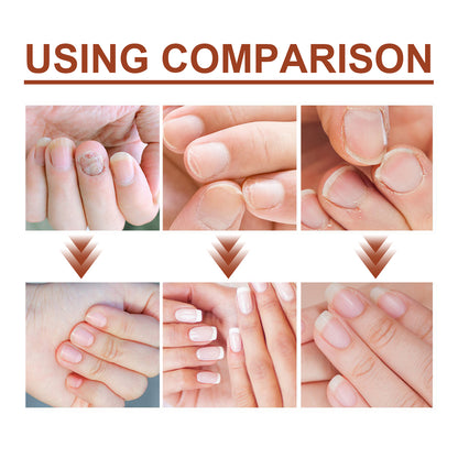 GDBadais 7 Day Nail Care Essence Grey Nail, Hand, Foot And Nail Nourishing Cleansing Essence