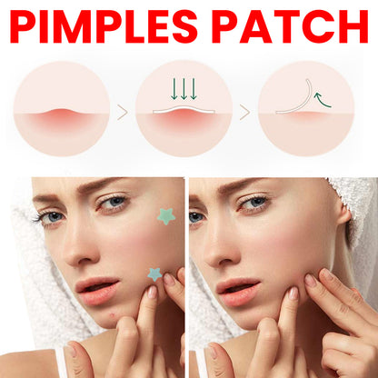 GDBadais Pimples Patch, Repair Pockmarks Lighten Pimples Blemishes Cover Pimples