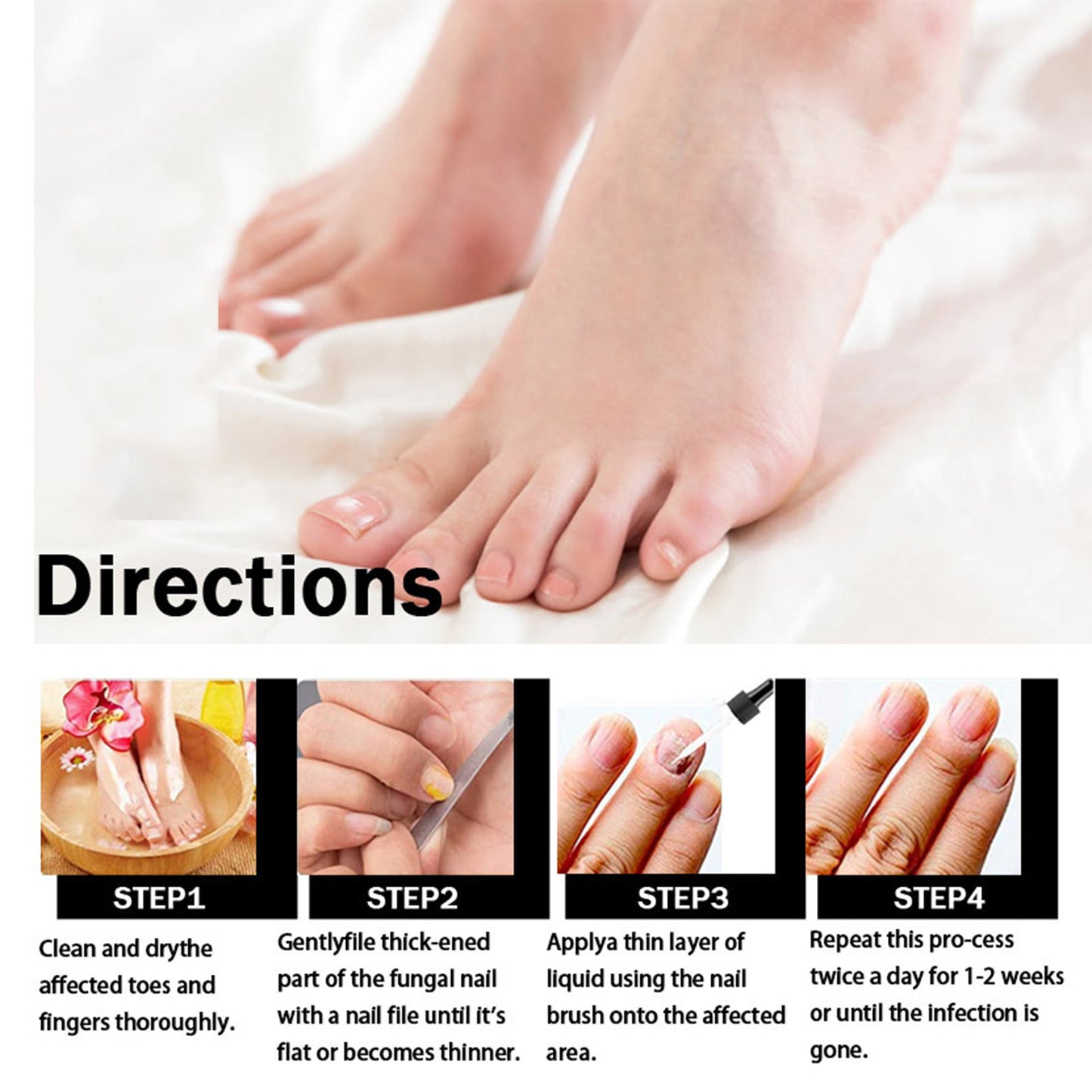 GDBadais Nail Repair Solution Thickening Brightening Nails Removing Gray Nails Dead Skin Repair Nourishing Nail Care Solution