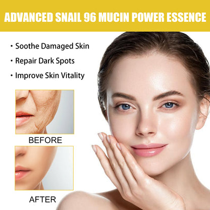 GDBadais Snail 96 Collagen Essence Lighten Fine Lines, Tender Skin and Moisturize acne muscles