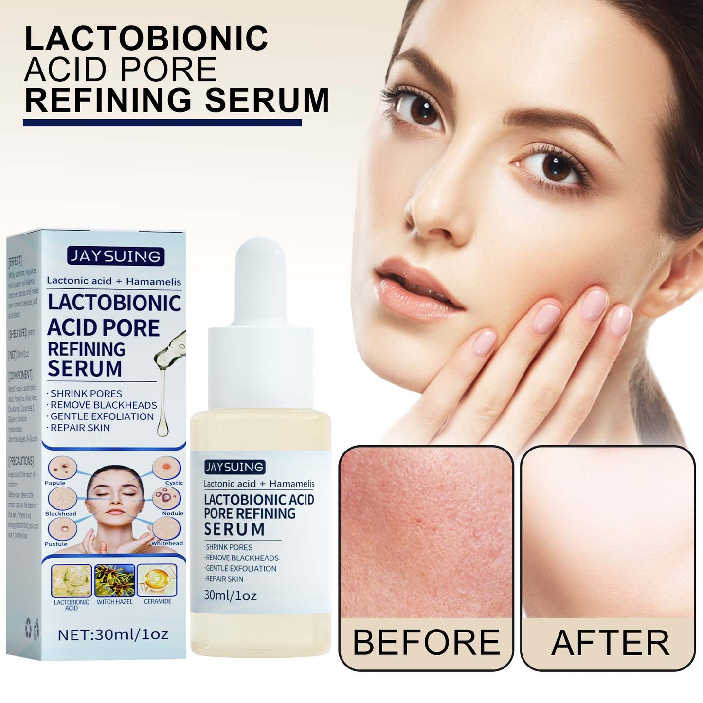 GDBadais Lactose Solution, Exfoliate Remove Blackheads Shrink Pores Clean And Moisturize SkinEssence