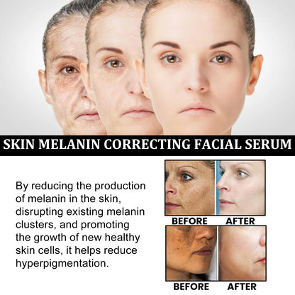 GDBadais Repair Face Essence Hydrates And Moisturizes Facial Skin To Improve Dull Skin Rejuvenation Essence