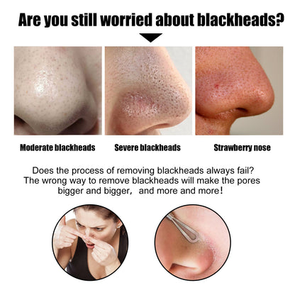 GDBadais Black Pig Nose Patch, Bamboo Charcoal Remove Blackhead Acne Tear Nose Mask Patch