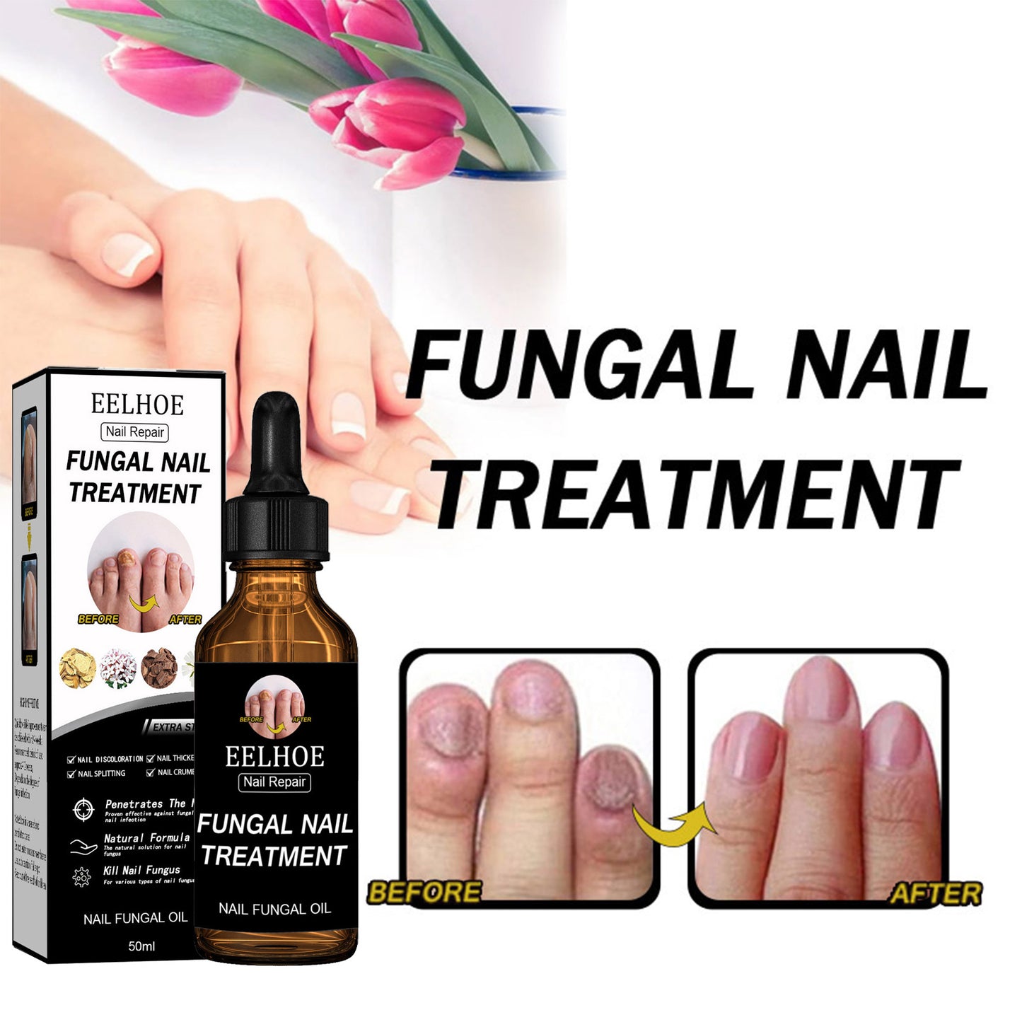 GDBadais Nail Repair Solution Thickening Brightening Nails Removing Gray Nails Dead Skin Repair Nourishing Nail Care Solution