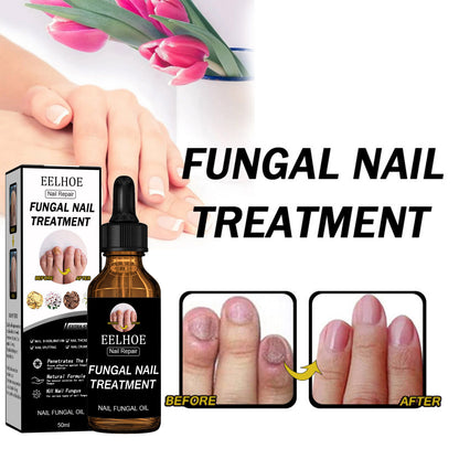 GDBadais Nail Repair Solution Thickening Brightening Nails Removing Gray Nails Dead Skin Repair Nourishing Nail Care Solution
