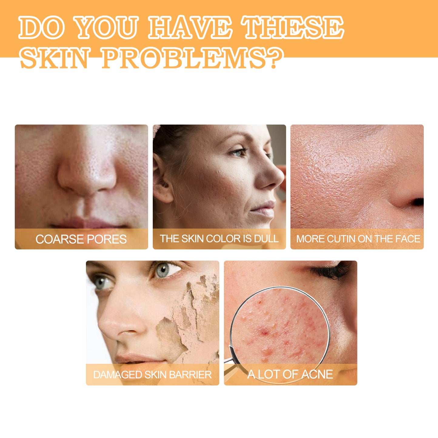 GDBadais Glycolic Acid 7% Toner, Remove Acne Lighten Acne Repair Acne Mark Moisturize Skin Toner