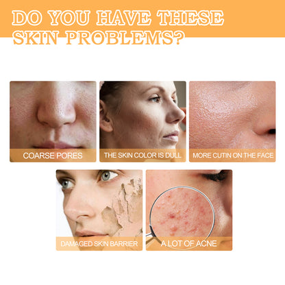 GDBadais Glycolic Acid 7% Toner, Remove Acne Lighten Acne Repair Acne Mark Moisturize Skin Toner