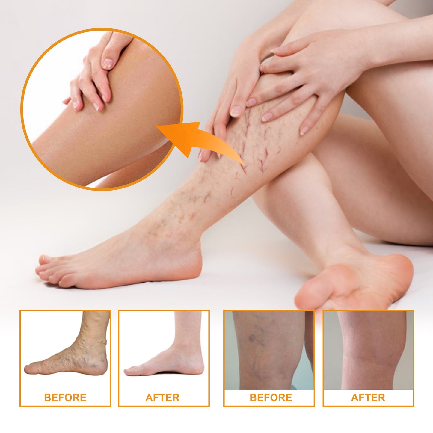 GDBadais Vitamin K Cream Skin Care For Sore And Swollen Legs Earthworm Leg Vein Massage Cream