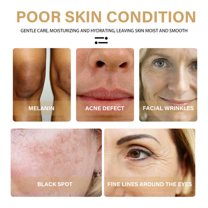 GDBadais Turmeric Correction Essence Facial Care Hydrating Moisturizing Gentle Moisturizing Skin Care Essence