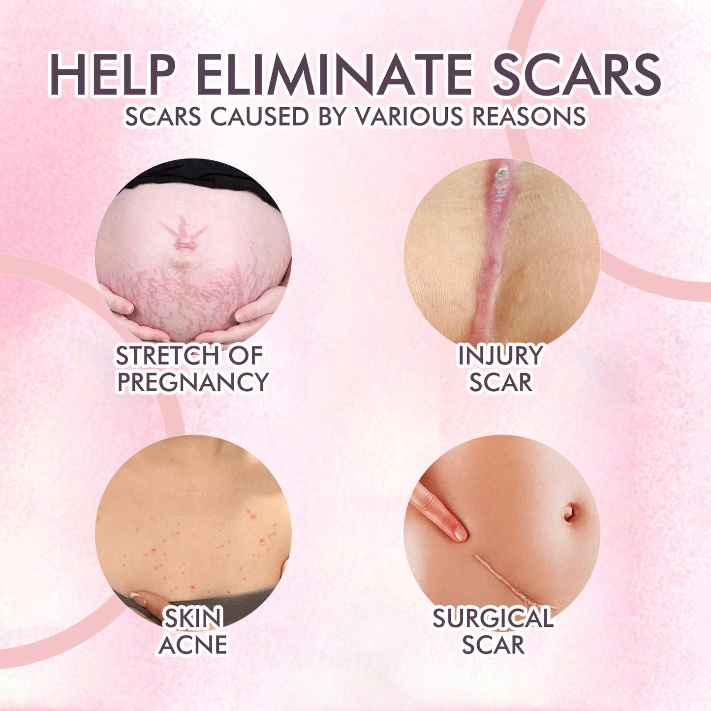 GDBadais Skincare Body Oil, Fade Scars And Fine Lines Of Pregnancy Moisturize And Repair Delicate And Smooth Body Skin