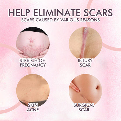 GDBadais Skincare Body Oil, Fade Scars And Fine Lines Of Pregnancy Moisturize And Repair Delicate And Smooth Body Skin