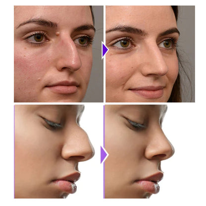 GDBadais Nose Shaper Nose Shape Shaper Nose Shape Shaper Nose Shape Shaper Nose Shape Shaper